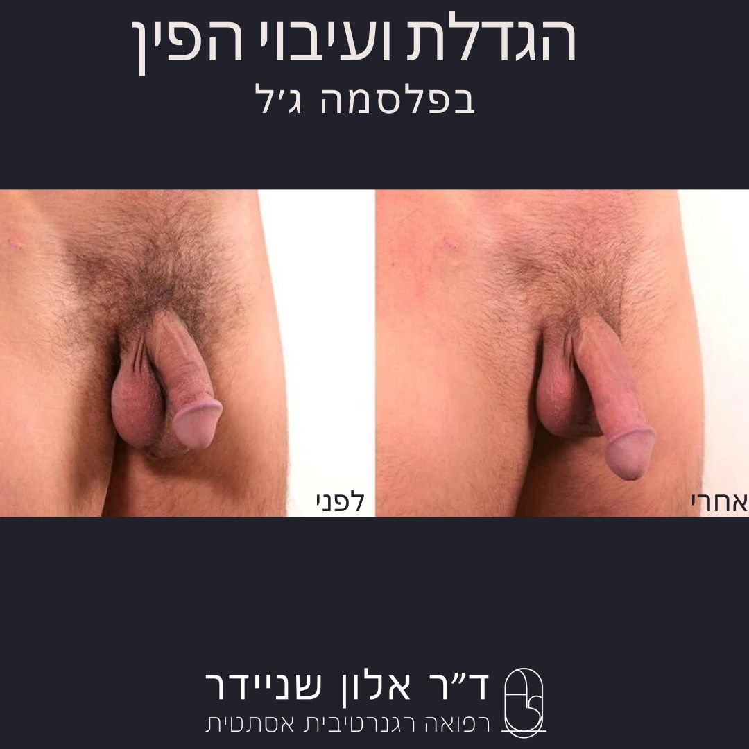 תמונה 4