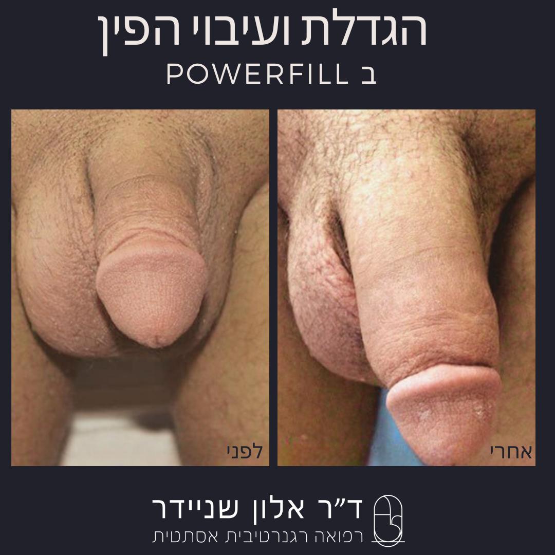 תמונה 4