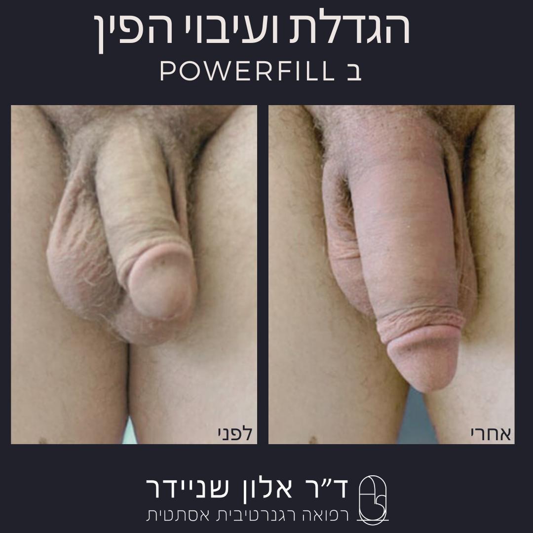 תמונה 4