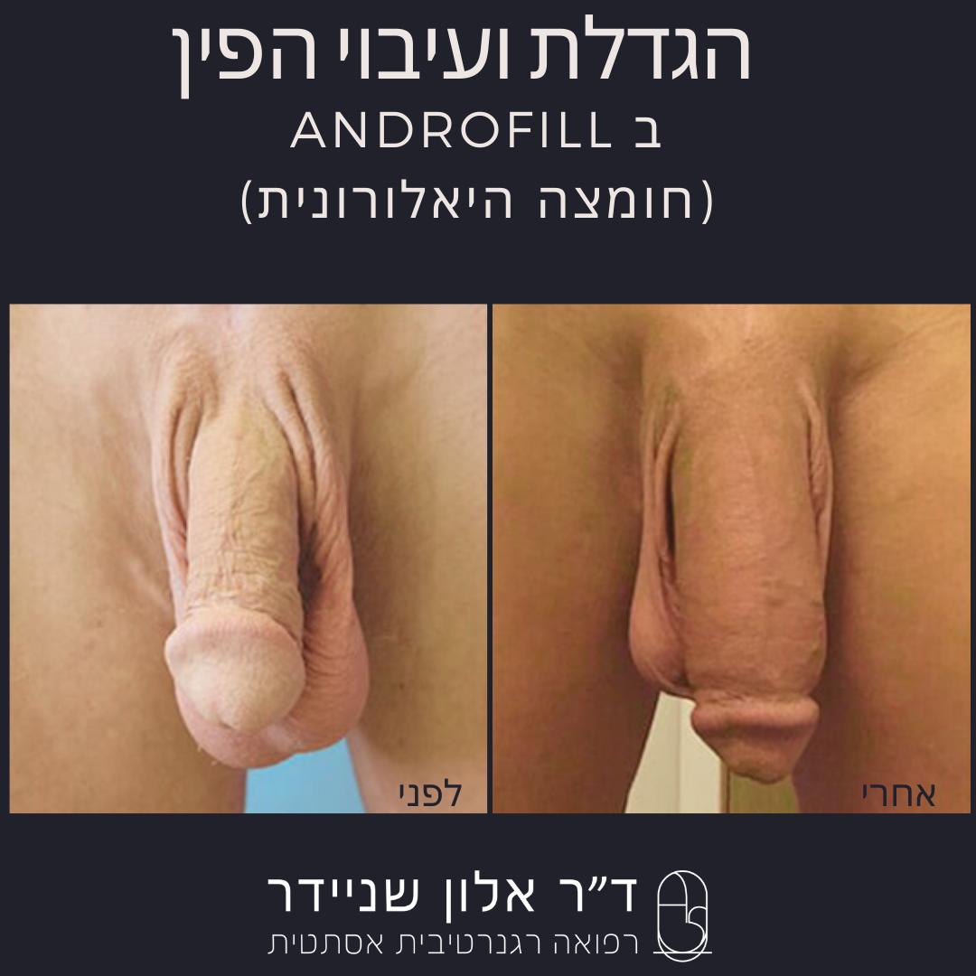 תמונה 4