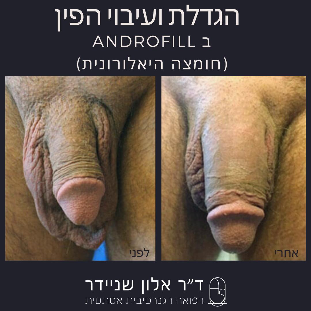 תמונה 4